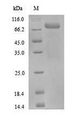 PADI3 Protein - (Tris-Glycine gel) Discontinuous SDS-PAGE (reduced) with 5% enrichment gel and 15% separation gel.