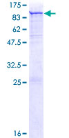 PADI3 Protein - 12.5% SDS-PAGE of human PADI3 stained with Coomassie Blue