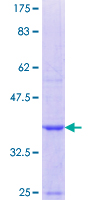 PADI3 Protein - 12.5% SDS-PAGE Stained with Coomassie Blue.