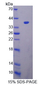 PADI3 Protein - Recombinant  Peptidyl Arginine Deimina Type III By SDS-PAGE