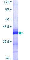 PADI4 / PAD4 Protein - 12.5% SDS-PAGE Stained with Coomassie Blue.