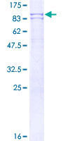 PADI4 / PAD4 Protein - 12.5% SDS-PAGE of human PADI4 stained with Coomassie Blue