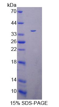 PADI4 / PAD4 Protein - Recombinant  Peptidyl Arginine Deimina Type IV By SDS-PAGE