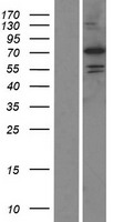 PADI6 Protein - Western validation with an anti-DDK antibody * L: Control HEK293 lysate R: Over-expression lysate