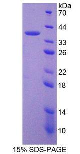 PADI6 Protein - Recombinant  Peptidyl Arginine Deiminase Type VI By SDS-PAGE