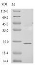 PAEP / Glycodelin / GdF Protein - (Tris-Glycine gel) Discontinuous SDS-PAGE (reduced) with 5% enrichment gel and 15% separation gel.