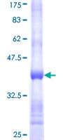 PAEP / Glycodelin / GdF Protein - 12.5% SDS-PAGE Stained with Coomassie Blue.