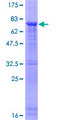 PAFAH1B1 / LIS1 Protein - 12.5% SDS-PAGE of human PAFAH1B1 stained with Coomassie Blue