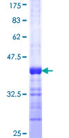 PAFAH1B1 / LIS1 Protein - 12.5% SDS-PAGE Stained with Coomassie Blue.