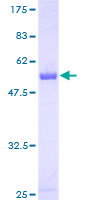 PAFAH1B2 Protein - 12.5% SDS-PAGE of human PAFAH1B2 stained with Coomassie Blue