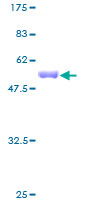PAFAH1B3 Protein - 12.5% SDS-PAGE of human PAFAH1B3 stained with Coomassie Blue