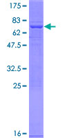 PAFAH2 Protein - 12.5% SDS-PAGE of human PAFAH2 stained with Coomassie Blue