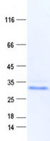 PAGE5 Protein - Purified recombinant protein PAGE5 was analyzed by SDS-PAGE gel and Coomassie Blue Staining