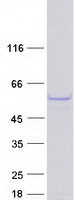 PAGR1 / C16orf53 Protein - Purified recombinant protein PAGR1 was analyzed by SDS-PAGE gel and Coomassie Blue Staining