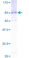 PAI-RBP1 / SERBP1 Protein - 12.5% SDS-PAGE of human PAI-RBP1 stained with Coomassie Blue
