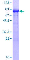 PAIP1 Protein - 12.5% SDS-PAGE of human PAIP1 stained with Coomassie Blue