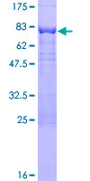 PAK1 Protein - 12.5% SDS-PAGE of human PAK1 stained with Coomassie Blue
