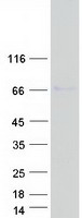 PAK1 Protein - Purified recombinant protein PAK1 was analyzed by SDS-PAGE gel and Coomassie Blue Staining