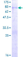 PAK1IP1 / HPIP1 Protein - 12.5% SDS-PAGE of human PAK1IP1 stained with Coomassie Blue