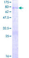 PAK1IP1 / HPIP1 Protein - 12.5% SDS-PAGE of human PAK1IP1 stained with Coomassie Blue