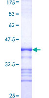 PAK2 Protein - 12.5% SDS-PAGE Stained with Coomassie Blue.