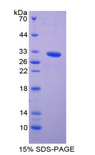 PAK2 Protein - Recombinant p21 Protein Activated Kinase 2 By SDS-PAGE