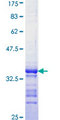 PAK4 Protein - 12.5% SDS-PAGE Stained with Coomassie Blue.