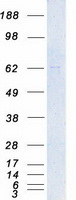 PAK4 Protein - Purified recombinant protein PAK4 was analyzed by SDS-PAGE gel and Coomassie Blue Staining
