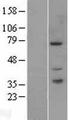 PAK6 Protein - Western validation with an anti-DDK antibody * L: Control HEK293 lysate R: Over-expression lysate