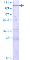 PAK6 Protein - 12.5% SDS-PAGE of human PAK6 stained with Coomassie Blue