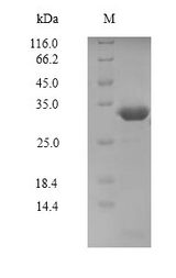 PAK7/PAK5 Protein - (Tris-Glycine gel) Discontinuous SDS-PAGE (reduced) with 5% enrichment gel and 15% separation gel.