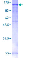 PAL / PAM Protein - 12.5% SDS-PAGE of human PAM stained with Coomassie Blue