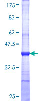 PAL / PAM Protein - 12.5% SDS-PAGE Stained with Coomassie Blue.