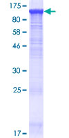 PALD1 / Paladin 1 Protein - 12.5% SDS-PAGE of human KIAA1274 stained with Coomassie Blue