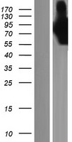 PALLD / Palladin Protein - Western validation with an anti-DDK antibody * L: Control HEK293 lysate R: Over-expression lysate