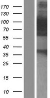 PALLD / Palladin Protein - Western validation with an anti-DDK antibody * L: Control HEK293 lysate R: Over-expression lysate