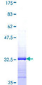 PALLD / Palladin Protein - 12.5% SDS-PAGE Stained with Coomassie Blue.