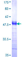 PALM2 Protein - 12.5% SDS-PAGE Stained with Coomassie Blue.