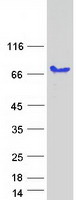 PALM2 Protein - Purified recombinant protein PALM2 was analyzed by SDS-PAGE gel and Coomassie Blue Staining