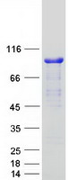 PALMD Protein - Purified recombinant protein PALMD was analyzed by SDS-PAGE gel and Coomassie Blue Staining