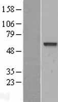 PALS2 / MPP6 Protein - Western validation with an anti-DDK antibody * L: Control HEK293 lysate R: Over-expression lysate