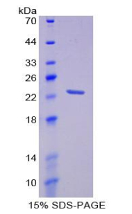 PALS2 / MPP6 Protein - Recombinant Membrane Protein, Palmitoylated 6 By SDS-PAGE