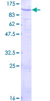 PAMR1 Protein - 12.5% SDS-PAGE of human DKFZP586H2123 stained with Coomassie Blue