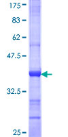 PAN3 Protein - 12.5% SDS-PAGE Stained with Coomassie Blue.
