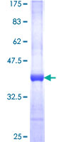 PANK1 / PANK Protein - 12.5% SDS-PAGE Stained with Coomassie Blue.