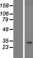 PANK2 Protein - Western validation with an anti-DDK antibody * L: Control HEK293 lysate R: Over-expression lysate