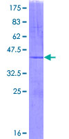 PANK2 Protein - 12.5% SDS-PAGE Stained with Coomassie Blue.