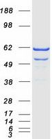 PANK2 Protein - Purified recombinant protein PANK2 was analyzed by SDS-PAGE gel and Coomassie Blue Staining