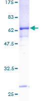 PANK3 Protein - 12.5% SDS-PAGE of human PANK3 stained with Coomassie Blue
