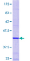 PANK3 Protein - 12.5% SDS-PAGE Stained with Coomassie Blue.